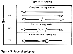 Type of stripping